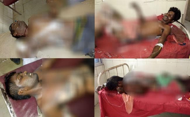 बाढ़ : रेलवे ट्रैक पर काम करते हाईटेंशन की चपेट में आने से 10 मजदूर झुलसे, लोगों ने की तोड़फोड़, धनबाद के हैं ज्यादातर मजदूर