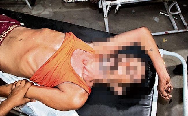 रांची : मेडिसिन वार्ड के बाथरूम से कूद कर मरीज ने की आत्महत्या की कोशिश, इमरजेंसी में भर्ती