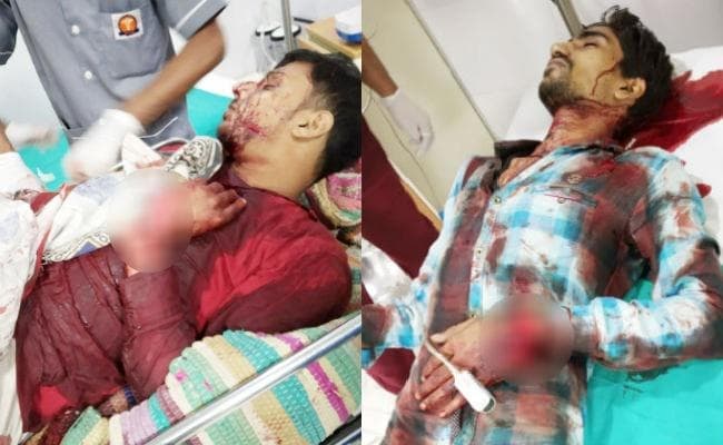 बांका : रेलवे क्रॉसिंग नहीं खोलने पर तीन युवकों ने रेलकर्मी के हाथ काट दिये, हाल जानने अस्पताल पहुंचे रेलमंत्री