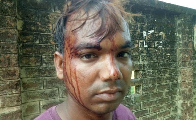 जमीन के विवाद में भतीजे पर लाठी, रॉड और ईंट से किया हमला, हुआ ये हाल