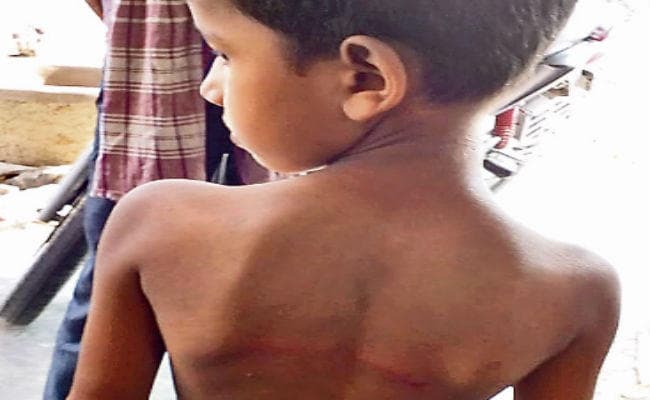 मोकामा : हाजिरी नहीं बोलने पर पहली कक्षा के छात्र को बेरहमी से पीटा