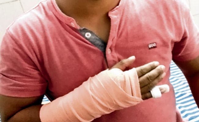 पटना : पीएमसीएच में हड़ताल खत्म, इधर फिर मारपीट, डॉक्टर के हाथ की टूटी अंगुली