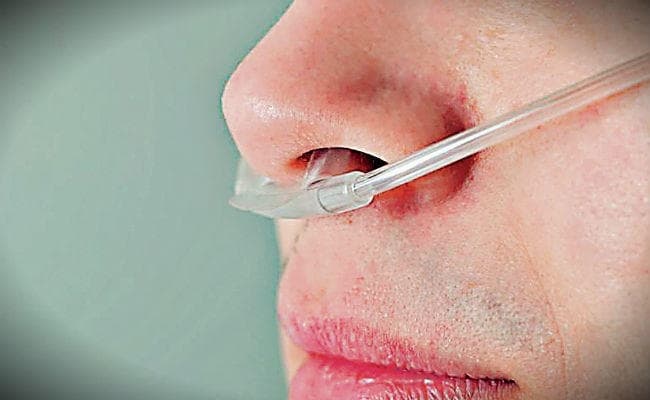 सांसों का दुश्मन है पल्मोनरी फायब्रोसिस