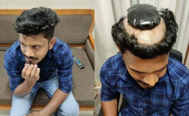 OMG! गोल्ड स्मगलिंग का इस शख्स ने निकाला ऐसा तरीका, जानकर आप भी होंगे हैरान...