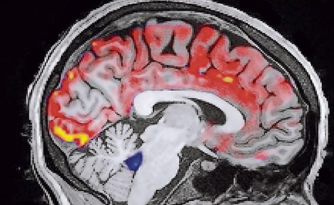 गहरी नींद के हैं कई लाभ, जानें