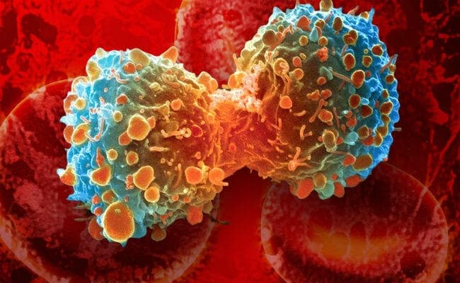 समय पर इलाज कैंसर रोकने का एक मात्र उपाय