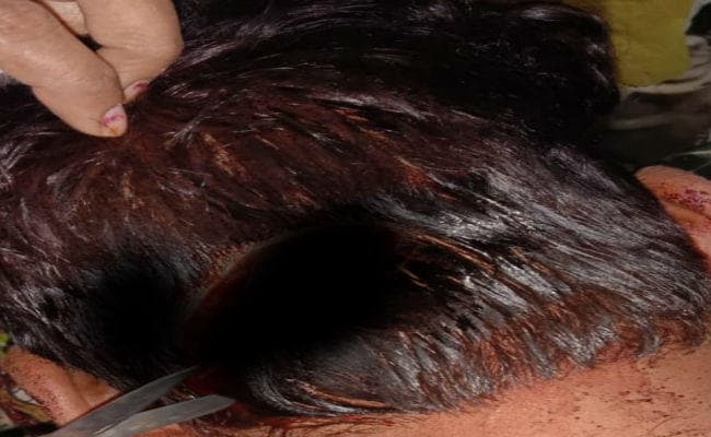 चौपारण में चार लोगों ने युवक पर किया धारदार हथियार से हमला, हालत गंभीर