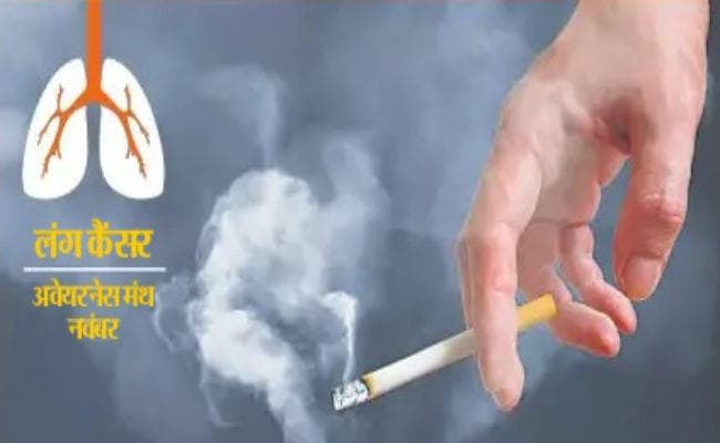 धुआं-धुआं हो रही है जिंदगी, जानें लंग कैंसर के विभिन्न चरण के संबंध में
