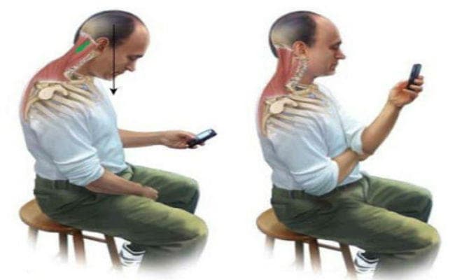 सर्वाइकल और कमर दर्द की वजह बन रहा स्मार्टफोन