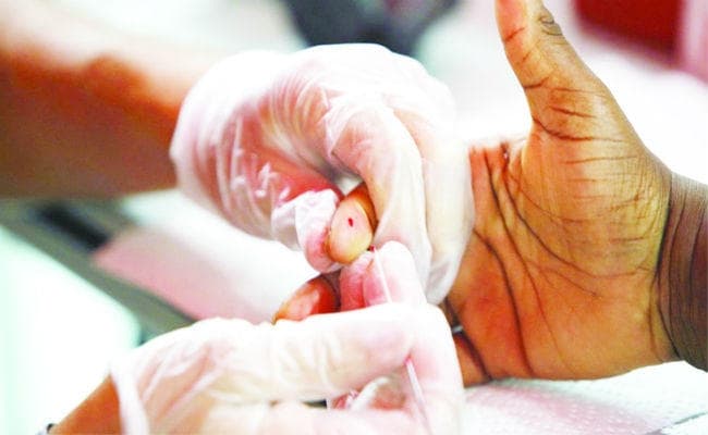 स्क्रब टाइफस को लेकर सरकारी अस्पतालों को अलर्ट रहने का निर्देश