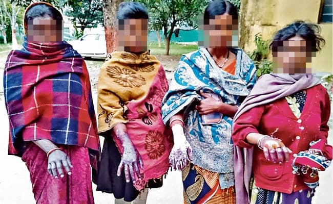 अनगड़ा : अंधविश्वास के मामले में पंचायत ने दी अनोखी सजा, गर्म पानी में हाथ डलवाये, किशोरी समेत चार महिला हुईं जख्मी