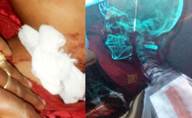 रोहतास : पहले किया दुष्कर्म का प्रयास, फिर घर में लगा दी आग, आज पीड़ित युवती को मार दी गोली