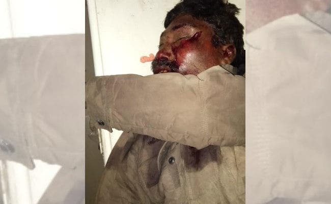 तेनुघाट के पास ट्रक दुर्घटना के कारण कथारा के एक व्यक्ति की मौत