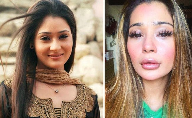 सारा खान की लिप सर्जरी पर भड़के फैंस, यूजर्स बोले- आपकी सर्जरी फेल हो गई