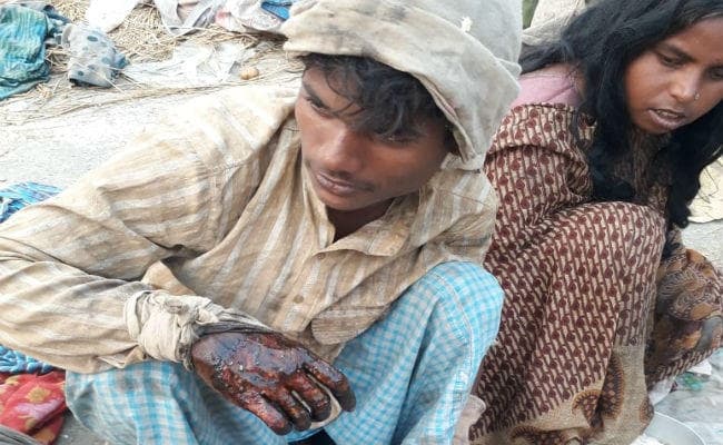 गंगासागर : मैदा, लाल रंग और जेली लगाकर घाव बनाते हैं, फिर बन जाते हैं भिखारी