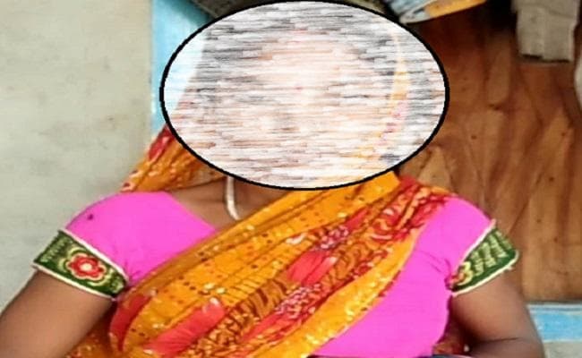 प्रसव के बाद महिला की गायब हो गयी एक किडनी, पीड़िता ने डॉक्टर पर लगाया आरोप