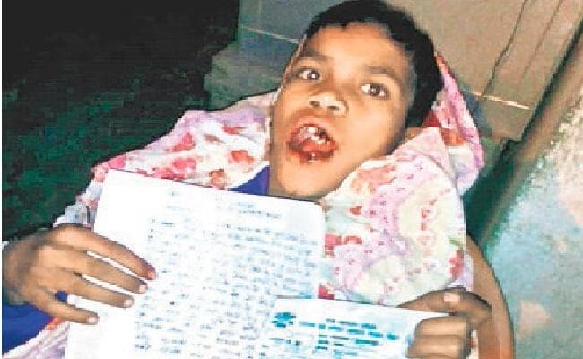 पेड़ से बच्चे ने तोड़ा बेर, गुस्से में बच्चे का तोड़ दिया जबड़ा, टूट गये छह दांत