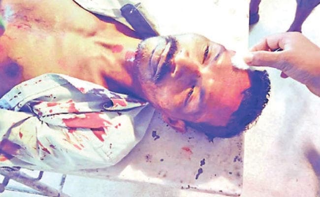 मालबाजार : डुआर्स में फिर तेंदुए का तांडव, चाय श्रमिक जख्मी