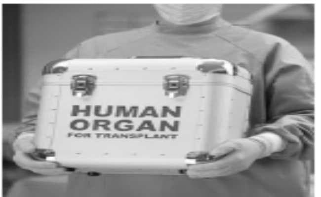 महानगर के अस्पतालों में नि:शुल्क होगा अंग प्रत्यारोपण