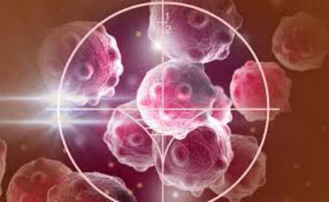 भागलपुर  :  एक सप्ताह में पांच से ज्यादा कैंसर के रोगी, कैंसर सेंटर पर टिकी उम्मीद, फंड का इंतजार