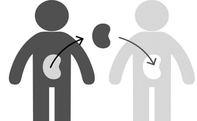 पटना : आइजीआइएमएस में 12 लाख में होगा लिवर ट्रांसप्लांट