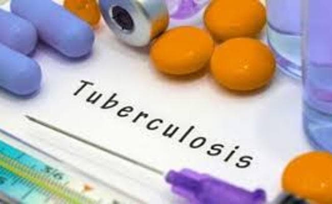 अब छह महीने नहीं कराना होगा टीबी का उपचार