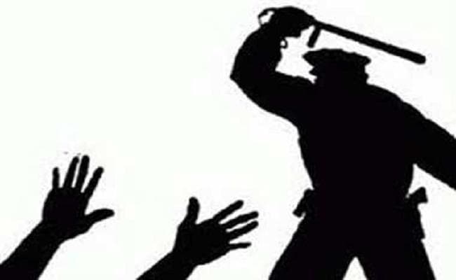 हरियाणवी भाषा बोलने पर बिहार पुलिस ने की परीक्षार्थी की बेरहमी से पिटाई