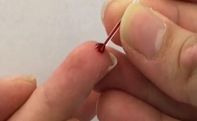 बिहार-झारखंड की 60 प्रतिशत से अधिक महिलाओं में खून की कमी