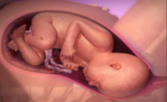 VIDEO देखकर अकेले बच्चे को जन्म देने की कोशिश में अविवाहिता की मौत