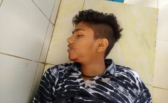 हजारीबाग रोड पर सड़क दुर्घटना में युवक की मौत, दो घायल