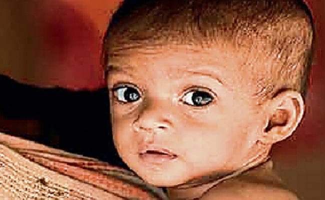 देश में दो फीसदी की दर से घटा कुपोषण