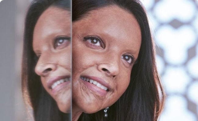 #Chhapaak में कुछ ऐसी दिखाई देंगी दीपिका पादुकोण