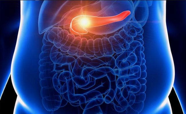 Health News : वजन अधिक होने से बढ़ सकता है अग्न्याशय कैंसर का खतरा