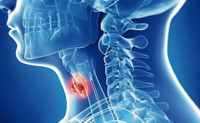 गले में वायरल इन्फेक्शन के बढ़ रहे मरीज, जानें कैसे करें बचाव