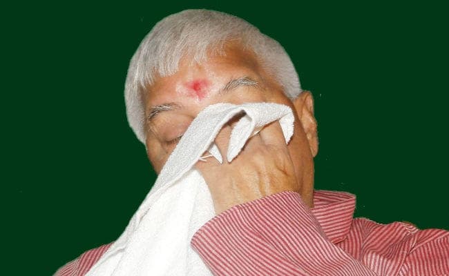 सीबीआई ने लालू की जमानत याचिका का किया विरोध, कहा- राजनीतिक गतिविधियों में हो सकते हैं शामिल