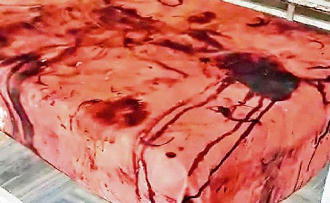 रांची : ओटी टेबल था गंदा, मरीज ने वीडियो वायरल किया