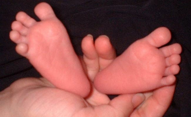 जापान : एक सेब के वजन के बराबर वजन का बच्चा घर जाने के लिए तैयार