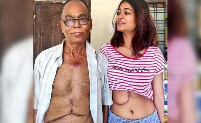 कोलकाता की बेटी ने अपने पिता को डोनेट किया लीवर