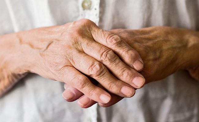 गठिया रोग में ऐसे मिलेगा होमियोपैथी से लाभ