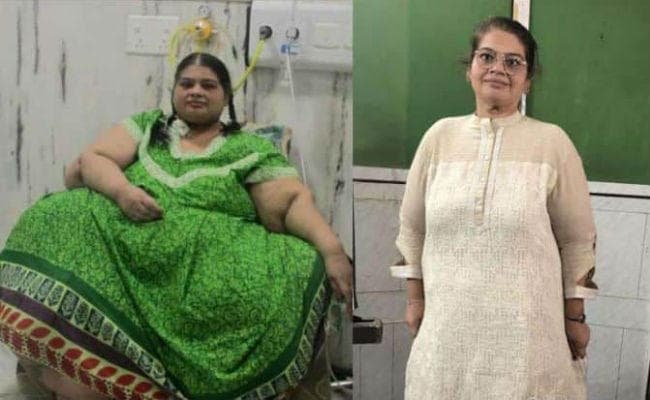 OMG : एशिया की सबसे भारी महिला ने घटाया 214 किलो वजन