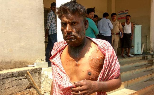 दरिंदे बाप ने दो मासूम बेटे को पेट्रोल छिड़ककर जिंदा जलाया, एक की मौत, दूसरे की स्थिति नाजुक