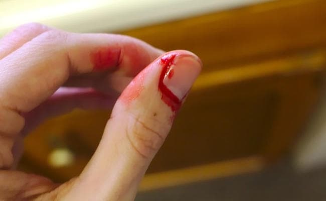 पसीना, खून व लार से मापा जा सकेगा तनाव