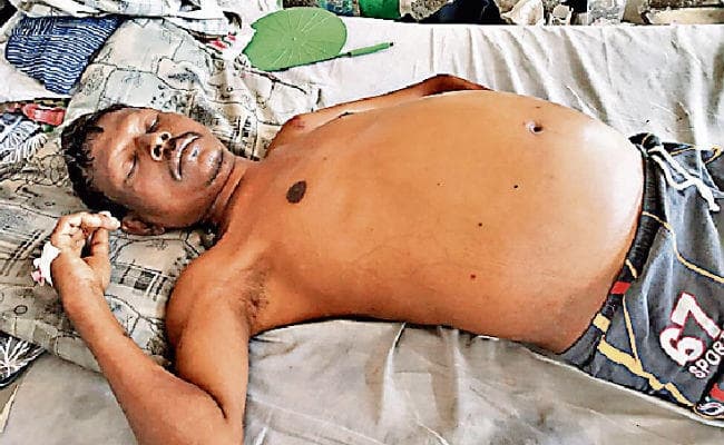 दवा के इंतजार में मौत से हार गया जीतू, रिम्स में आयुष्मान भारत के तहत चल रहा था इलाज