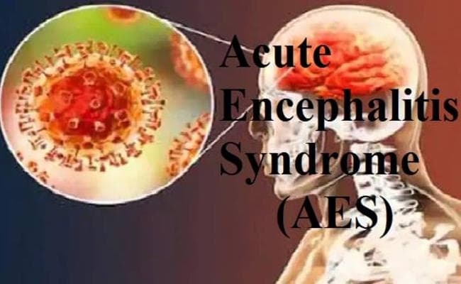 बिहार में तबाही मचाने वाले चमकी बुखार से निबटने के लिए रिसर्च जरूरी, मिल सकती है मधुमेह की नयी दवा