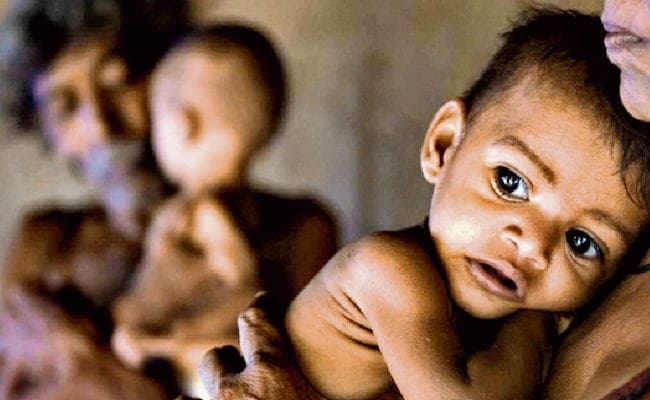 48.3 प्रतिशत बच्चों के नाटेपन का कारण है कुपोषण