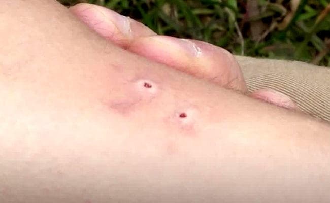 साली की शादी समारोह में शामिल होने ससुराल आये श्रवण को सांप ने डसा, खेल रही बच्ची की सांप के डसने से मौत