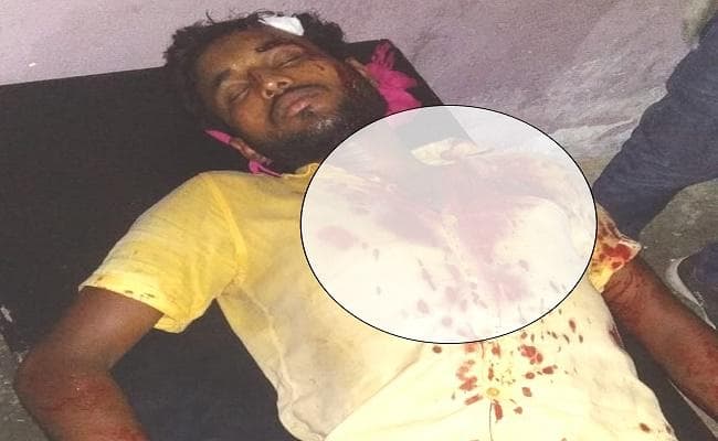 आर्केस्ट्रा में फरमाइशी गीत बजाने को लेकर खूनी संघर्ष, तीन जख्मी