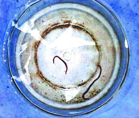 अकबरपुर अस्पताल में देखकर पीएं पीने का पानी, यहां पीने के पानी में रेंगते हैं कीड़े