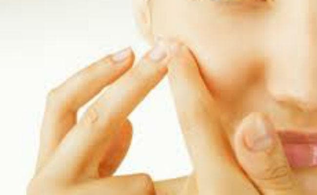 शरीर में टॉक्सिन्स की अधिकता मुहांसों का कारण, जानें रोकथाम और बचाव के उपाय