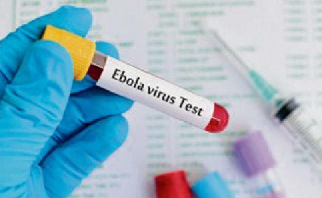 इबोला के प्रति ऐसे बरतें सतर्कता